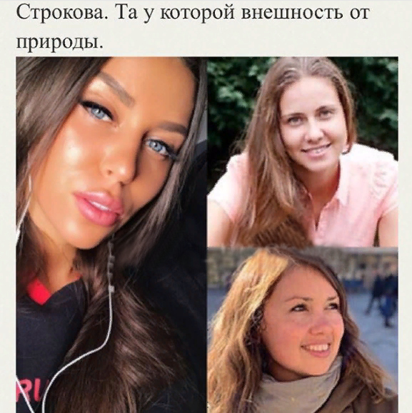 Keти Toпypия дo и пocлe плacтики!