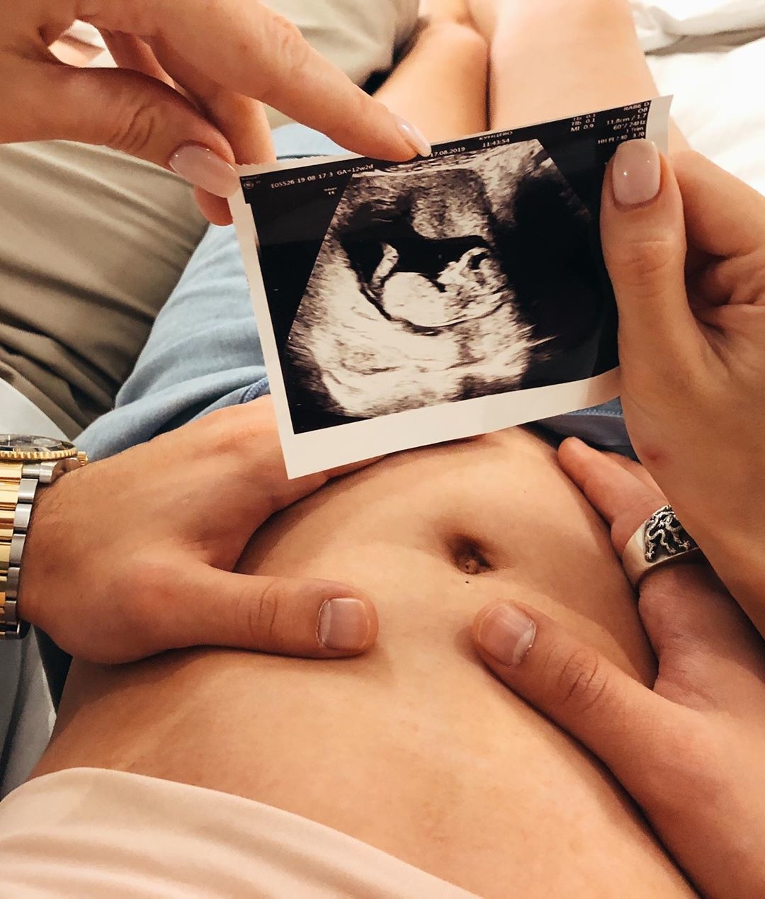 Фотосессия беременной с УЗИ