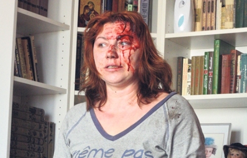 Роза Андреева заявила, что муж жестоко избивал ее ​Фото: Соцсети 
