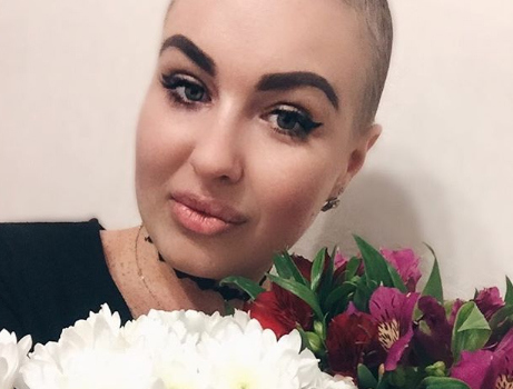 После химиотерапии Елена потеряла волосы ​Фото: «Инстаграм»  
