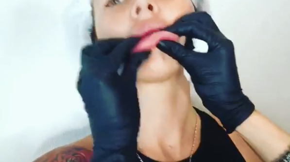 Саша хочет избавиться от губ, которые сделала на прошлой неделе Фото: «Инстаграм» 