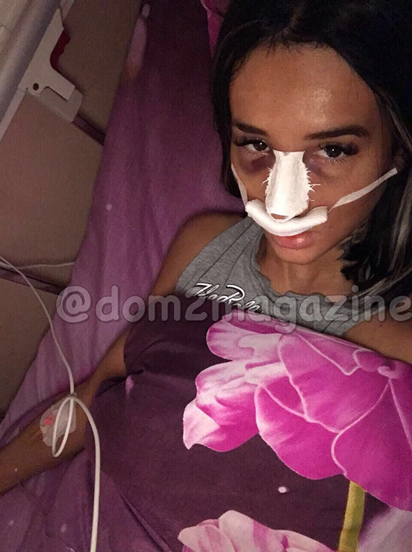 Марина Мексика после операции ​Фото: Личный архив 