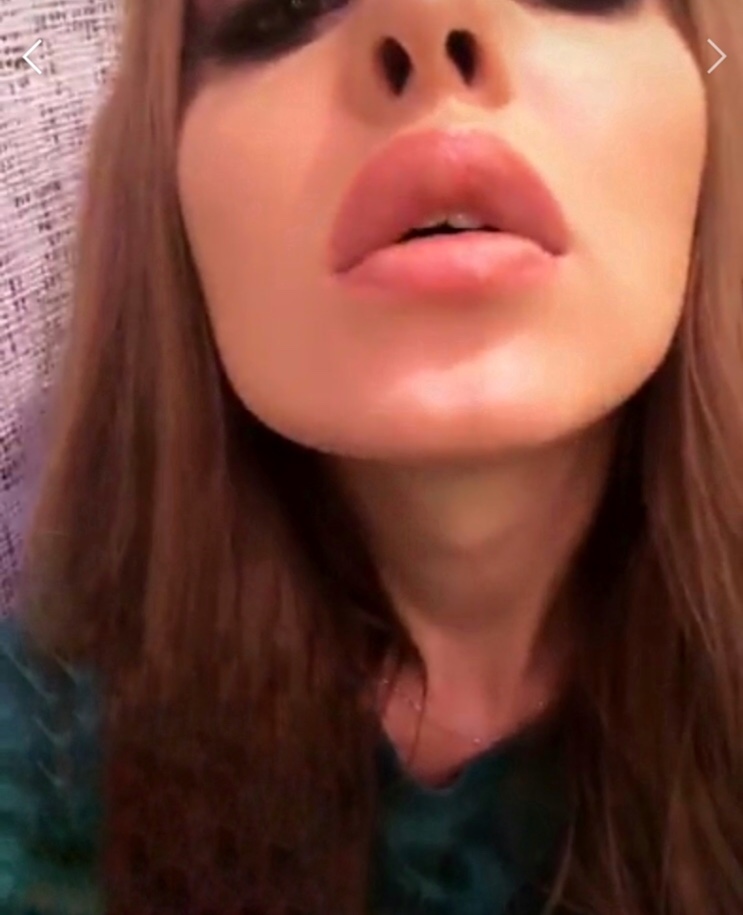 Юлия Ефременкова накачала губы ​Фото: «Инстаграм» 