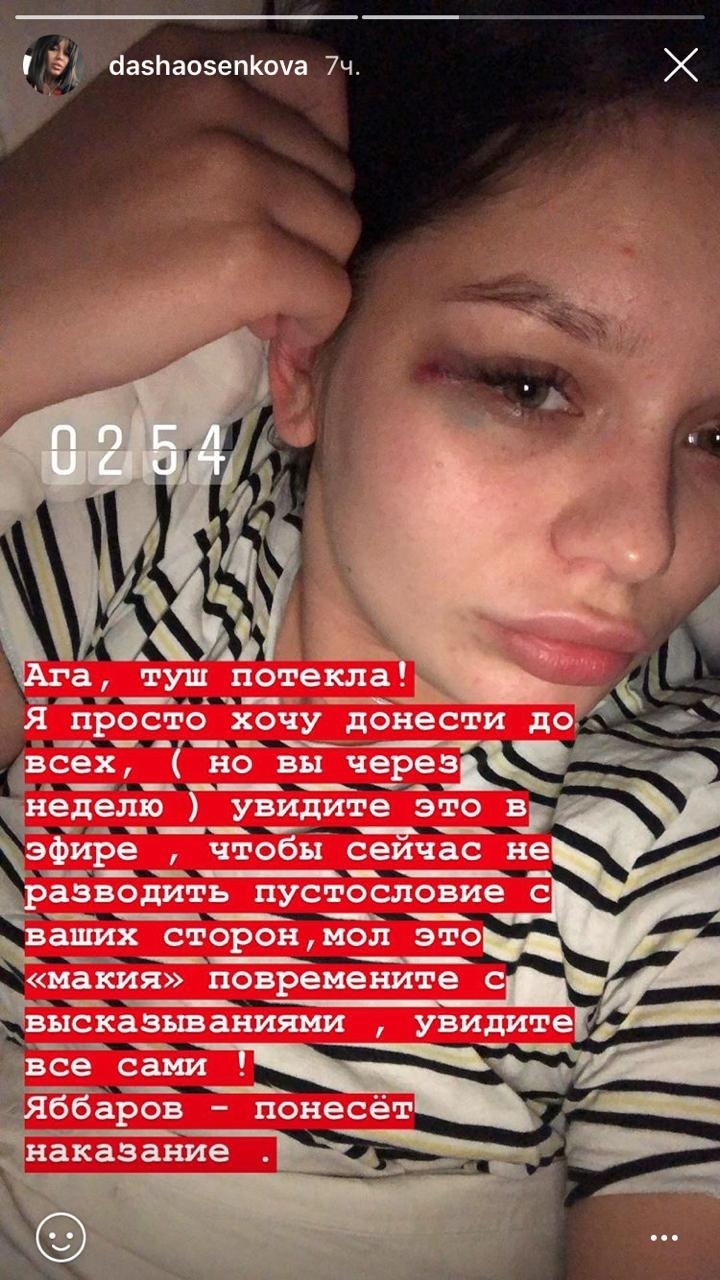 Даша заявила, что Илья ее избил Фото: «Инстаграм» 