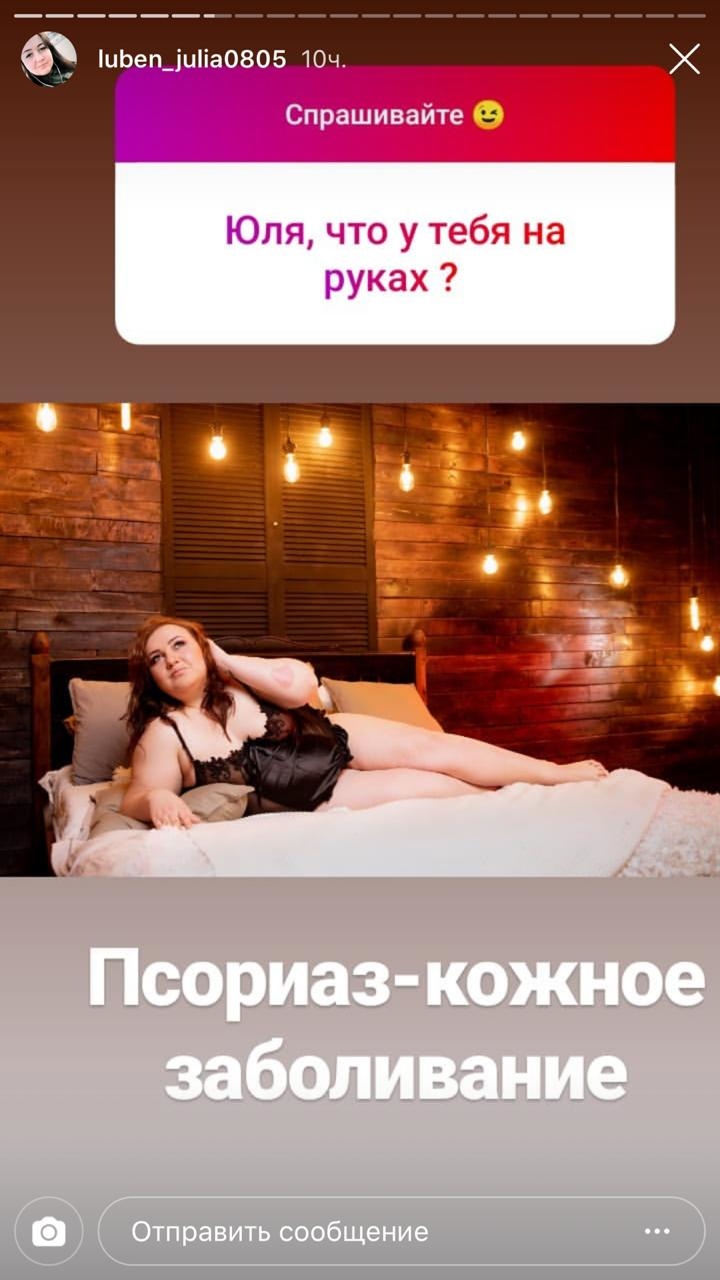 Молодая мама болеет псориазом ​Фото: «Инстаграм» 