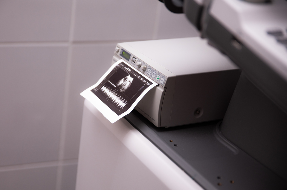 У экс-участницы шоу «Спаси свою любовь» сложная беременность. 