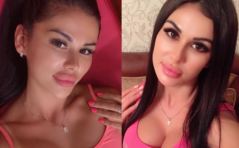 Роза Максимова до и после уменьшения губ Фото: «Инстаграм»  