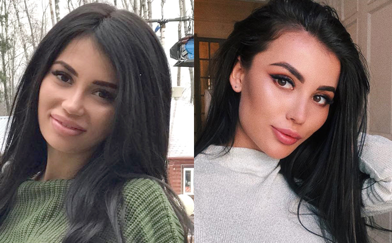 Лиля Четрару до и после уменьшения губ Фото: «Инстаграм»  