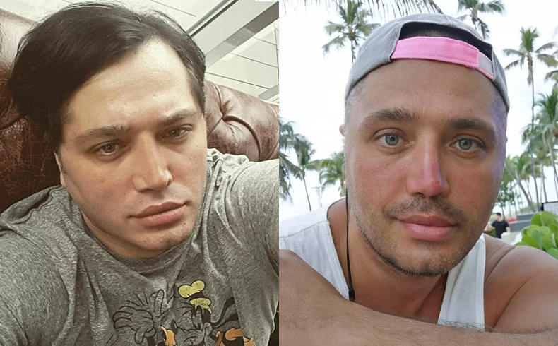Рустам Солнцев до и после уменьшения губ Фото: «Инстаграм»  