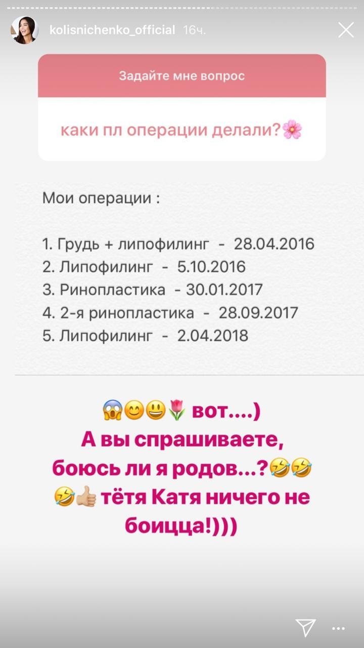 Катя Колисниченко рассказала обо всех своих пластических операциях&nbsp; Фото: «Инстаграм» 