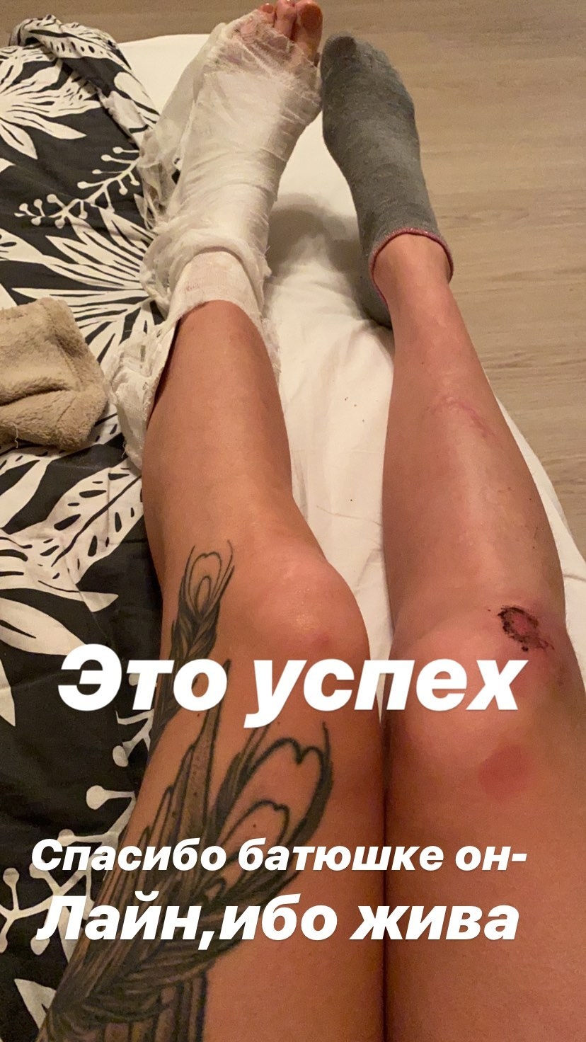 Бритни Спирс сломала ногу во время танца