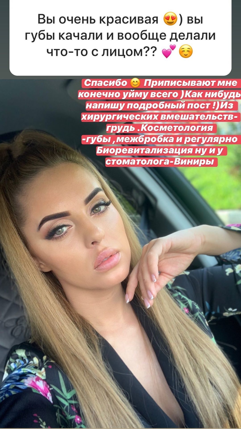 Ефременкова раскрыла правду о пластике&nbsp; ​Фото: «Инстаграм» 