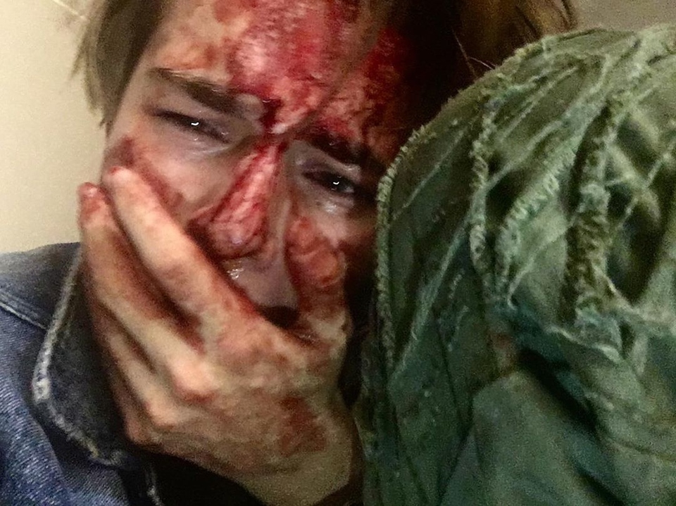 Никита ужаснул кровавыми фото после избиения ​Фото: «Инстаграм» 